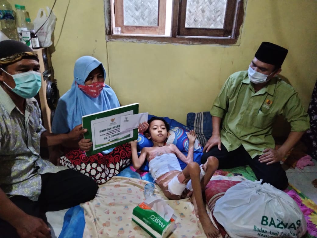 Baznas Bersama Dinsos Kabupaten Bekasi Kunjungi Anak Korban Luka Bakar